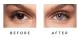  Cosmetic Lenses Pearl