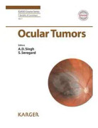 Ocular Tumors