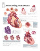 Understanding Heart Disease Paper Poster