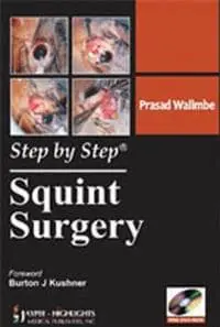 Step by Step: Squint Surgery