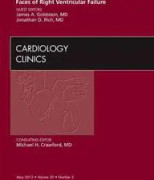 Faces of Right Ventricular Failure, An Issue of Cardiology Clinics