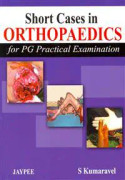 Short Cases in Orthopaedics