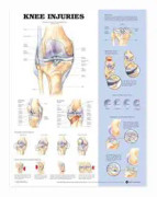 Knee Injuries Anatomical Chart