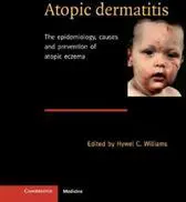 Atopic Dermatitis