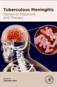Tuberculous Meningitis