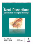 Neck Dissections