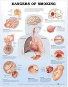 Dangers of Smoking Anatomical Chart