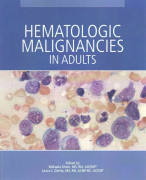 Hematologic Malignancies in Adults