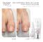 Pharm foot - reCONSTRUCTOR PODO nail set - Victoria Vynn