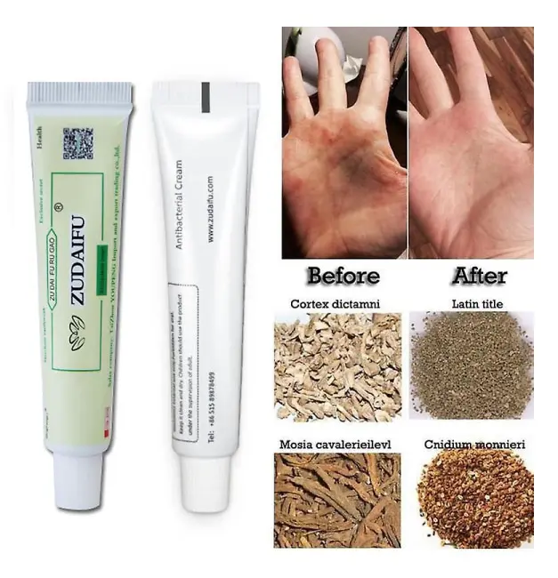 Dermatit Eksem Eksem Salva Behandling
