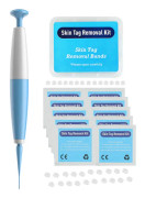 Skin Tag Remover - Smärtfri Skin Tag Removal Kit Tool for Small (2mm) to Me