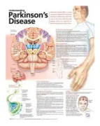 Understanding Parkinson's Disease Anatomical Chart