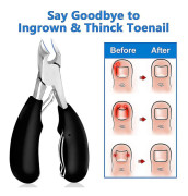 Barsinfi Toenail Sax, Ingrown/tjocka tånaglar, tånagel trimning och Podiatrist tång