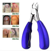 Professional Toenail Clippers For Thick Or Ingrown Toenails - Precision Nail Clippers With Straight Lines