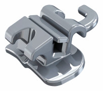 Konvertibelt buckalrör - Convertible Buccal Tube Mbt.022 Upper Left -14T 10A