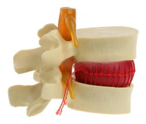 Anatomisk modell av mänsklig ländkota för medicinsk utbildning och klinisk träning, transparent modell av ländryggen med flexibel disk yellow