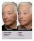 Instant FirmX Temporary Face Tightener