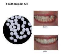 10g/100g Tooth And Space Denture Solid Glue Resin Denture Adhesive Dental Dentist Denture Solid Glue Temporary Tooth Restoration Kit