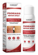 Psoriasisbehandlingsspray, med en ren naturlig reparationsformula, lindrar hudrodnad, klåda och andra obehag med en mild formula.